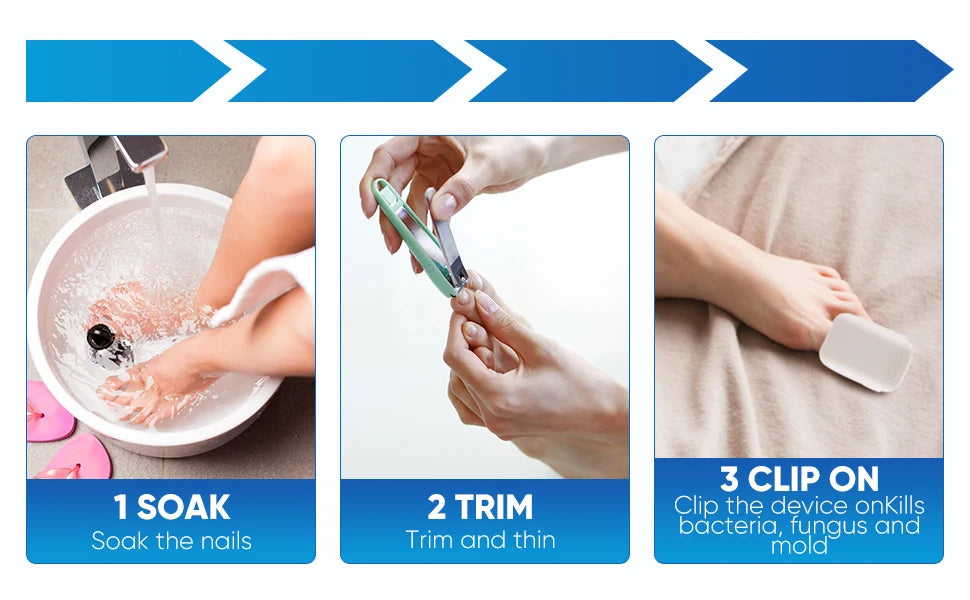 Nail Fungus Laser Treatment Device Repair Toenail Fingernail Fungus Treat Onychomycosis Laser Nails with Mushrooms Relaxation