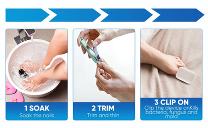 Nail Fungus Laser Treatment Device Repair Toenail Fingernail Fungus Treat Onychomycosis Laser Nails with Mushrooms Relaxation