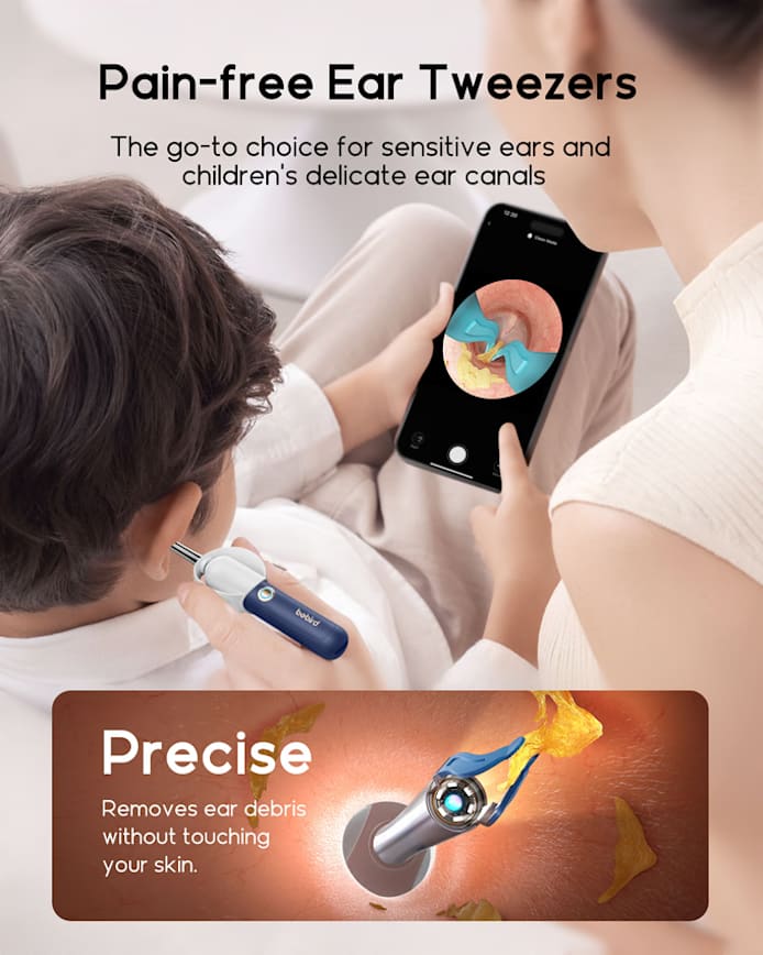 2025 New Bebird Earsight Plus I35R Ear Wax Removal Tool Camera Cleaner Kit- HD Wireless Flexible Otoscope, Pain-Free Ear Tweezer